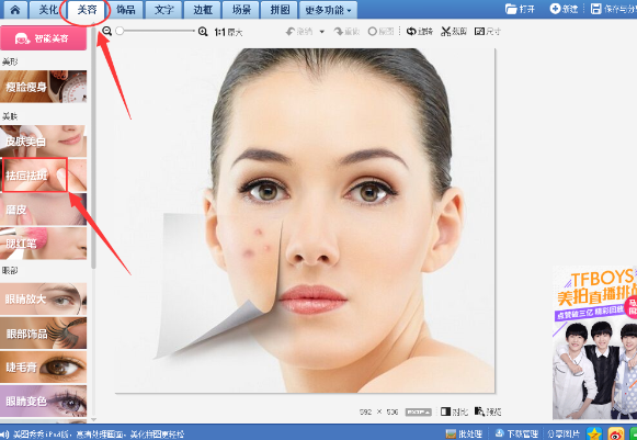 美圖秀秀怎么去除痘痘疤痕？美圖秀秀去除痘痘疤痕圖文教程