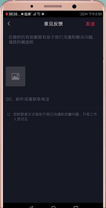 在抖音里怎么聯系客服?聯系客服的方法說明