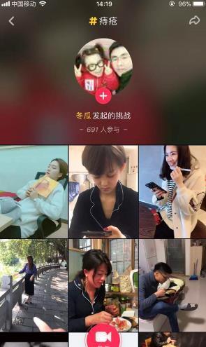 抖音周云鵬痔瘡段子拍攝方法教程分享